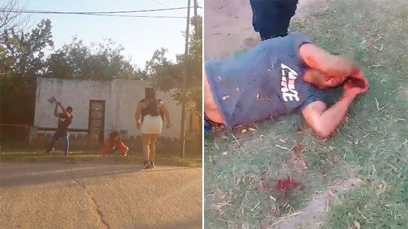 Intento de femicidio en San Salvador Sujeto que golpeó con una pala a