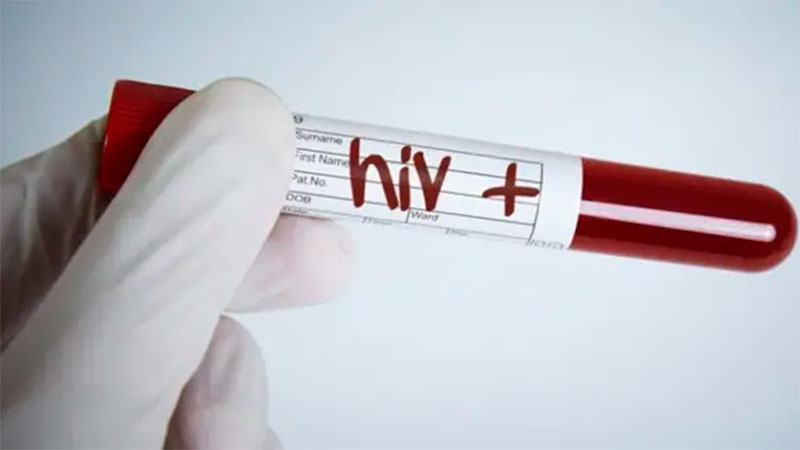 Lanzaron un programa nacional de investigación en VIH