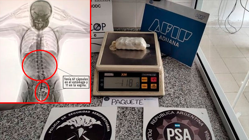 Detienen a joven con 78 cápsulas de cocaína en su cuerpo al intentar viajar a España
