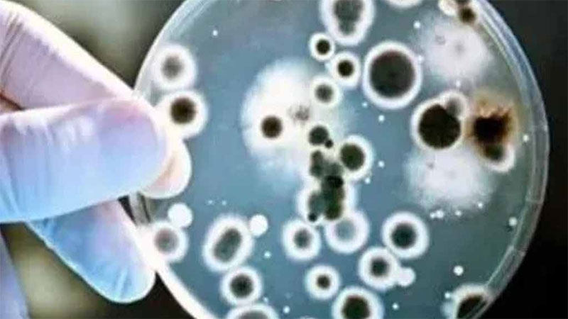 Estudios afirman que Streptococcus pyogenes ocasiona un muerto por día