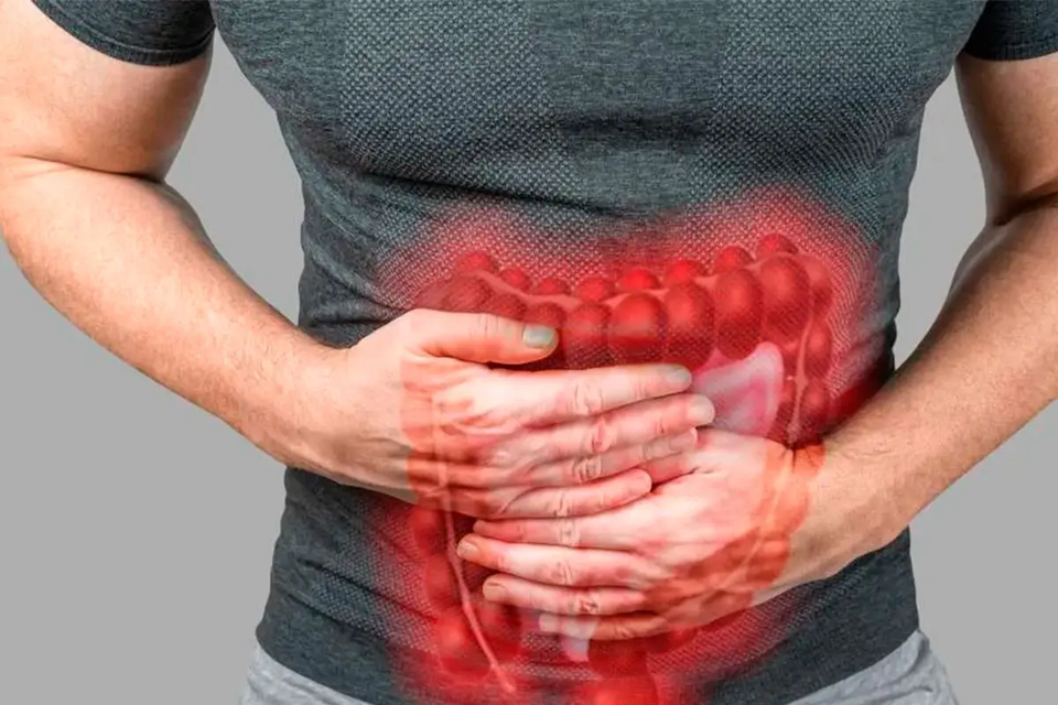 Cáncer de colon: cuales son las señales tempranas y cómo detectar la enfermedad