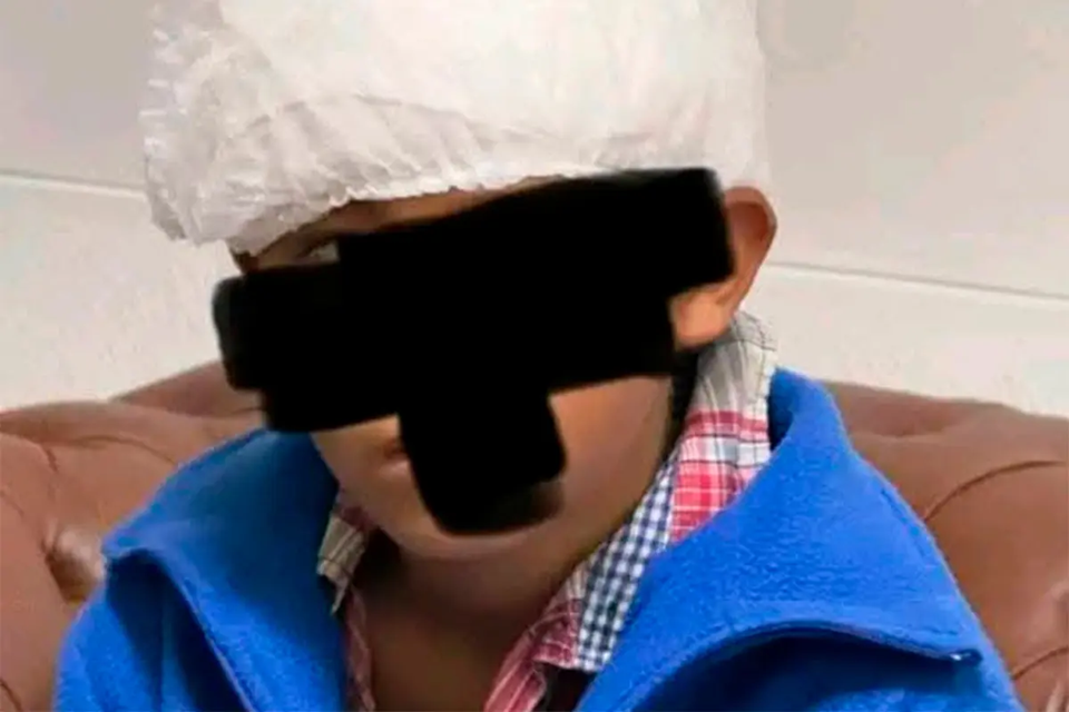 Un niño sufrió hundimiento de cráneo tras brutal golpiza